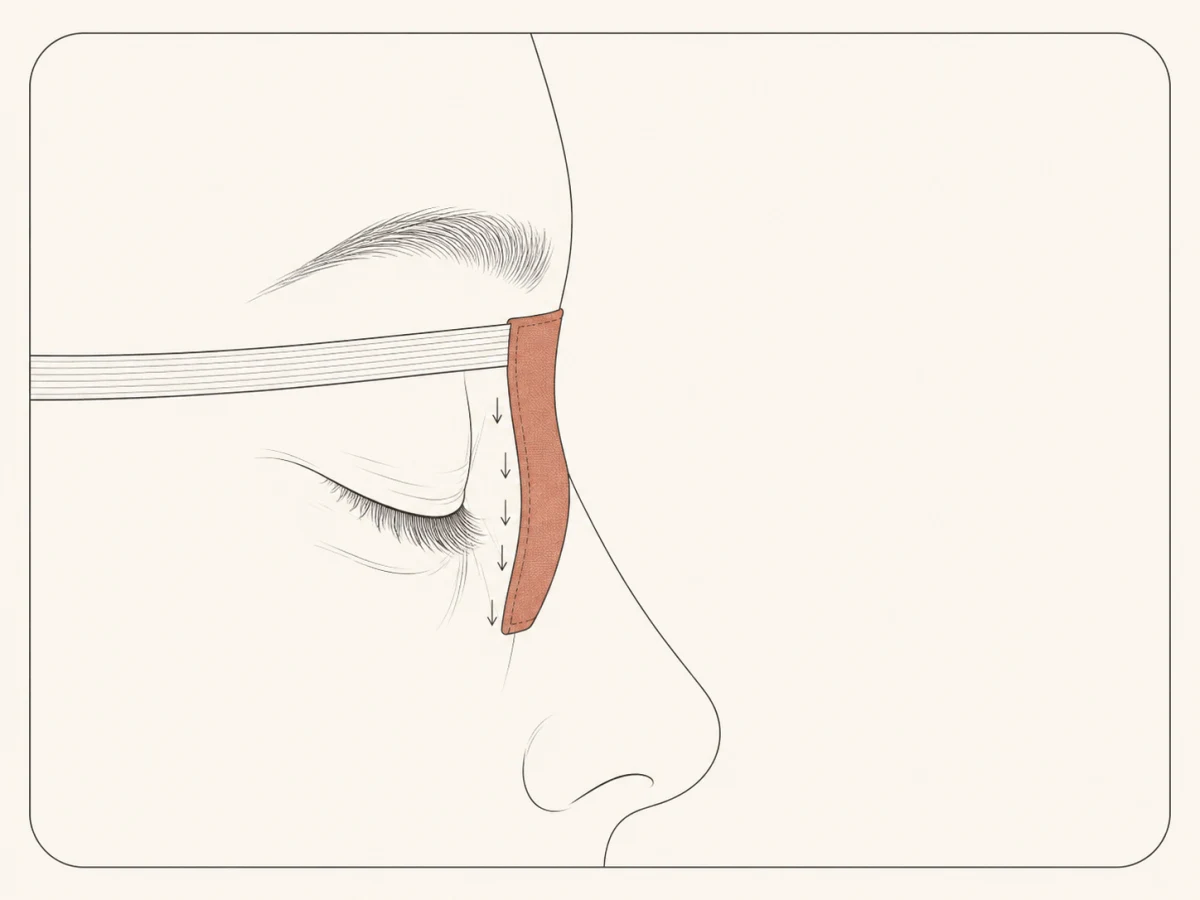 Coupe latérale d’un visage endormi : le tissu d’un masque plat épouse la paupière et pousse la peau du contour de l’œil vers le bas.